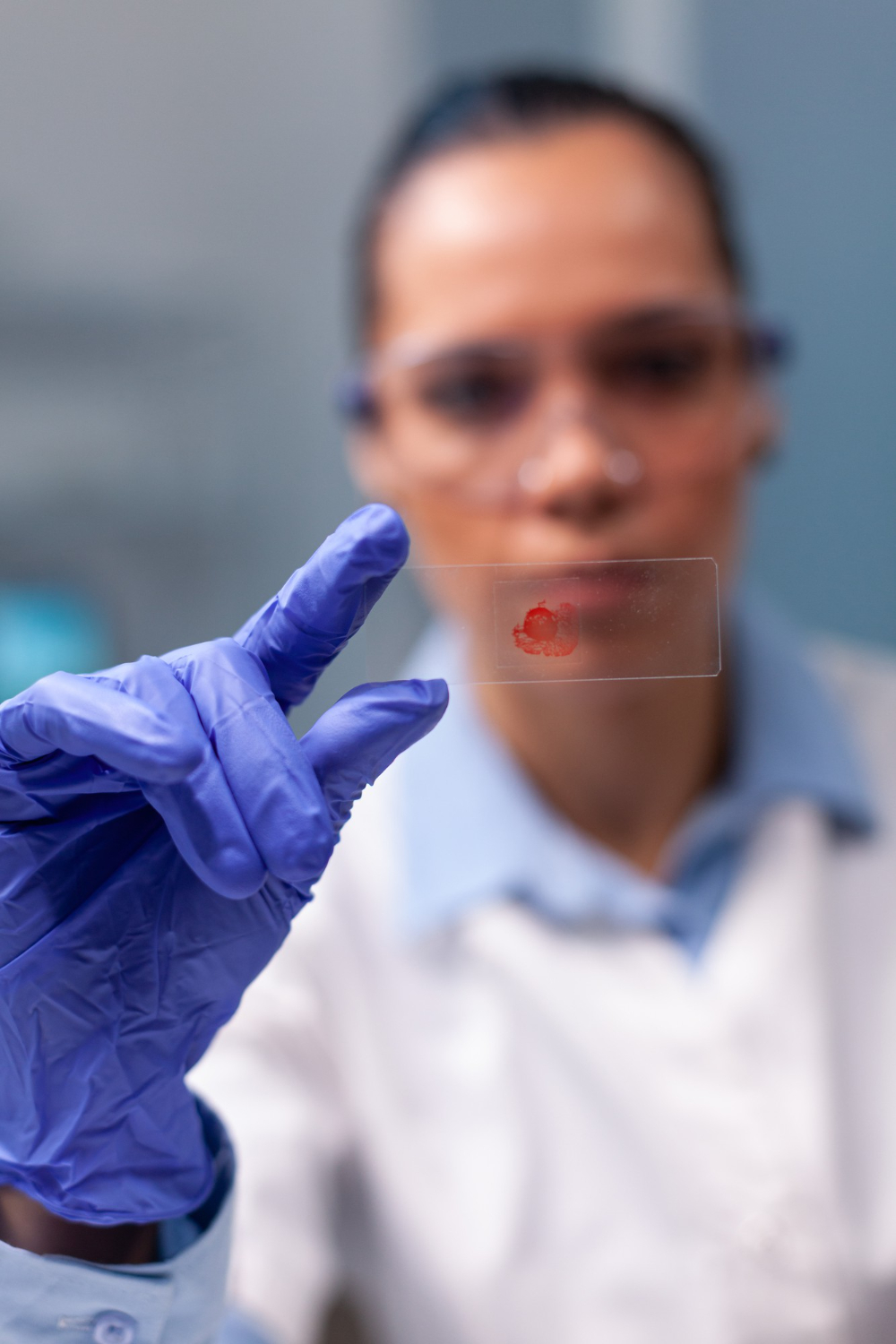 Ministério da Saúde abre consulta pública sobre novo teste para diagnosticar infecção fúngica grave